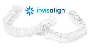 インビザラインはマウスピース型のカスタマイズ矯正歯科装置